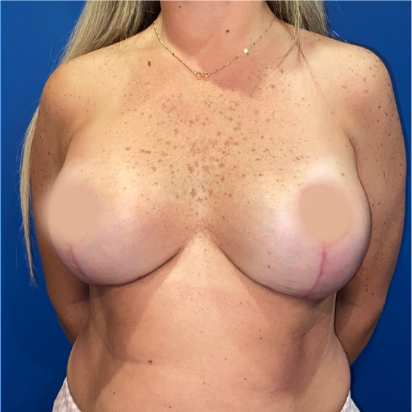 After image